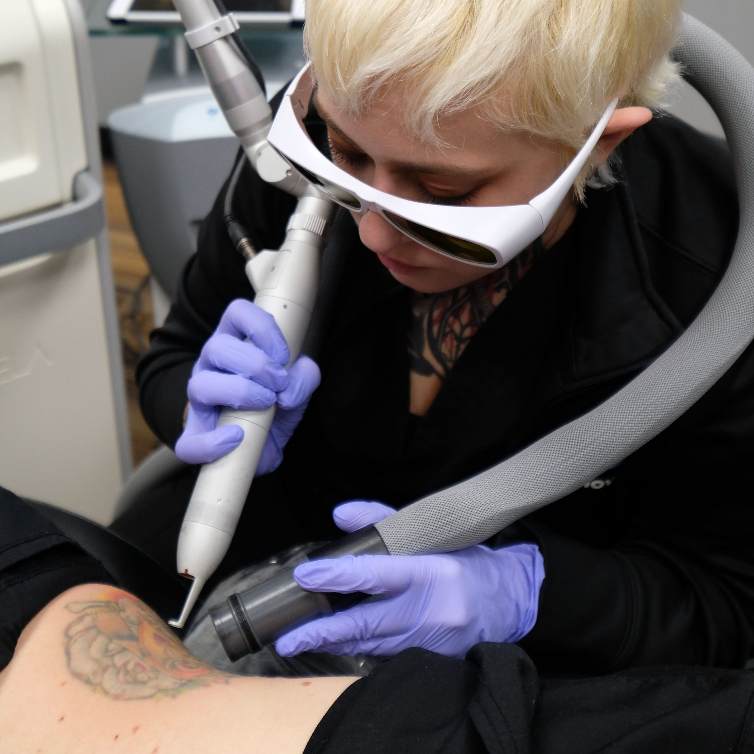 A major advance in laser technology for tattoo removal